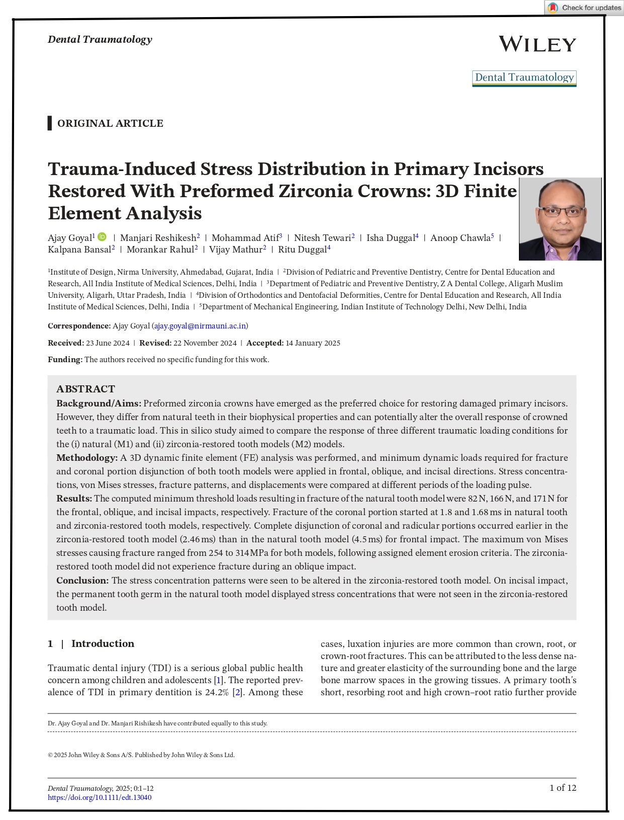 Trauma-Induced Stress Distribution in Primary Incisors Restored With Preformed Zirconia Crowns: 3D Finite Element Analysis